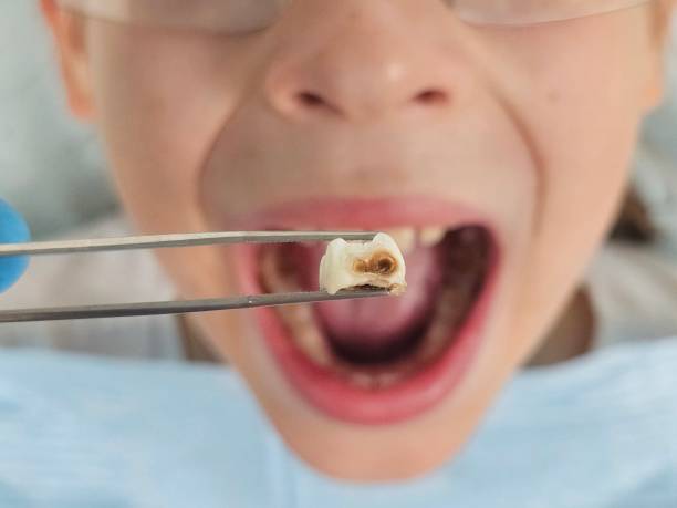 Best Emergency Dental Care for Trauma or Injury in Cottonde, AL